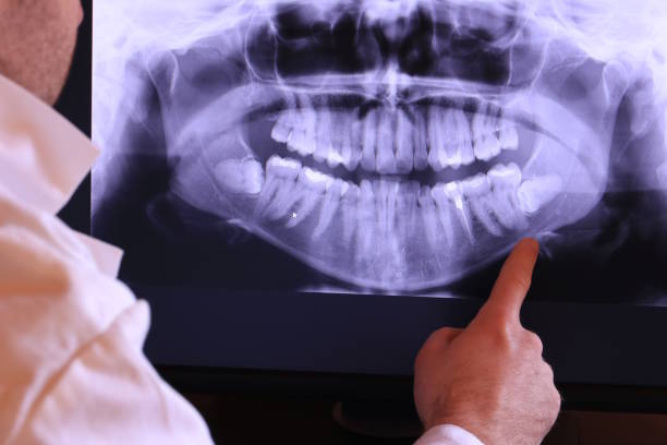 Best Emergency Dental Care for Abscessed Tooth in Galax, VA